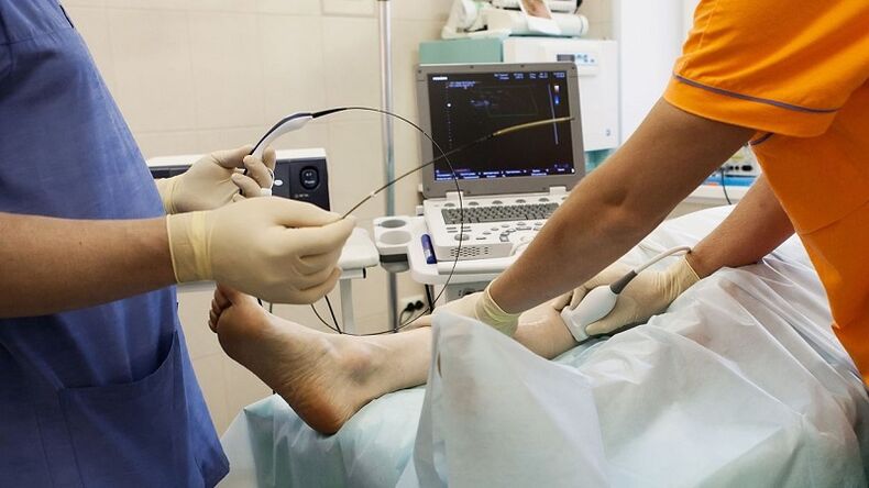 operace k odstranění křečových žil